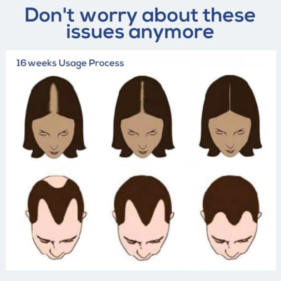 Red Light Therapy Hair Growth  - огляд і ціна Red Light Therapy Device